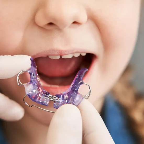 W jakim wieku należy zapisać dziecko do ortodonty?