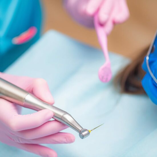 Jak leczenie kanałowe wpływa na estetykę uśmiechu?