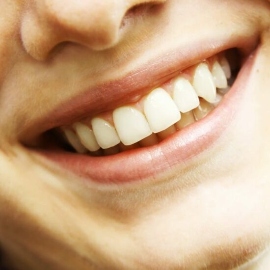 W jaki sposób wykonuje się bonding?