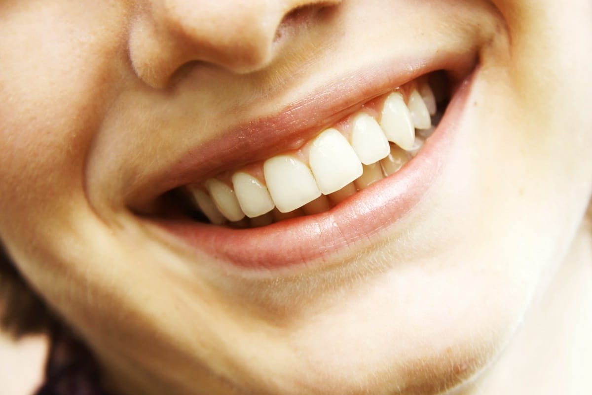 W jaki sposób wykonuje się bonding?